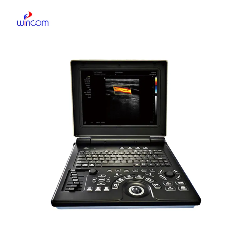 កុំព្យូទ័រយួរដៃ Color Doppler ប្រព័ន្ធវិនិច្ឆ័យ Ultrasonic USS-N20C